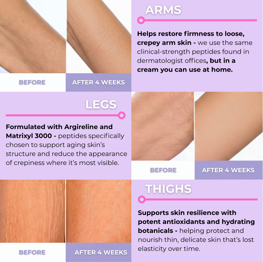 Mireaux™ Elasticity Restore Cream by Dr. Resa Alamuti