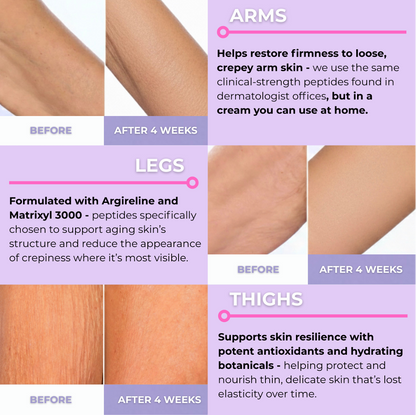 Mireaux™ Elasticity Restore Cream by Dr. Resa Alamuti