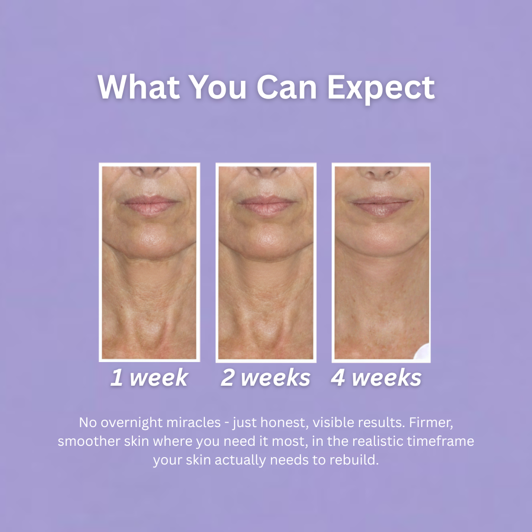 Mireaux™ Elasticity Restore Cream by Dr. Resa Alamuti