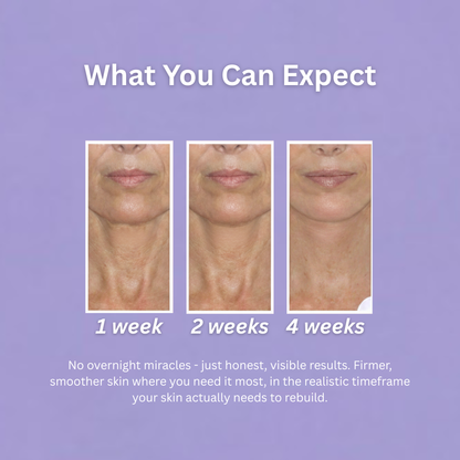 Mireaux™ Elasticity Restore Cream by Dr. Resa Alamuti